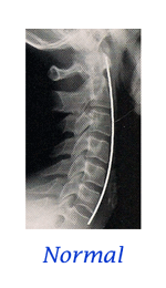 Normal Neck Curve